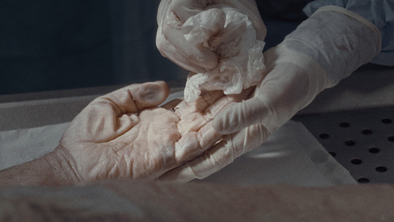 Gloved hands clean a cadaver hand